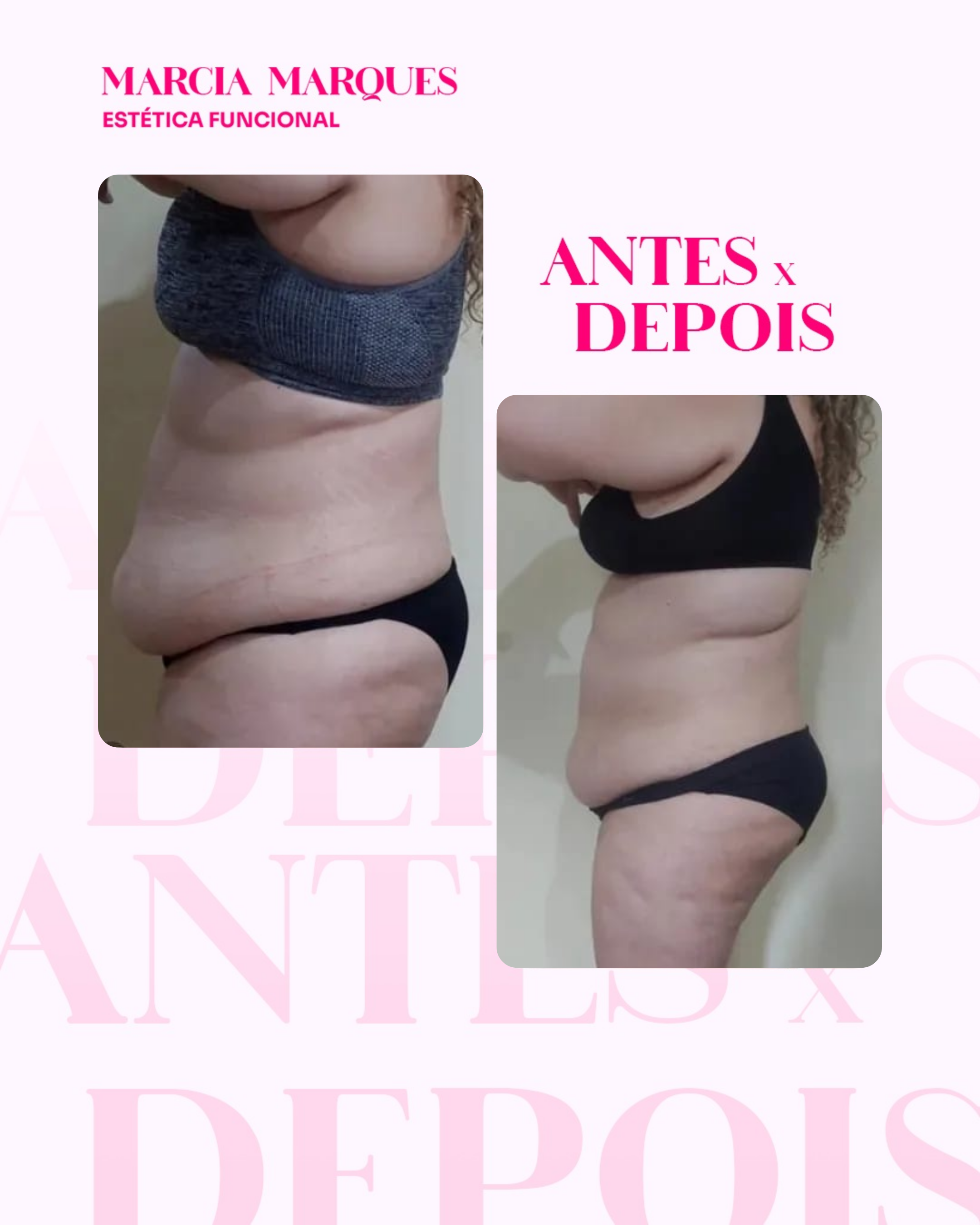Antes e Depois 8